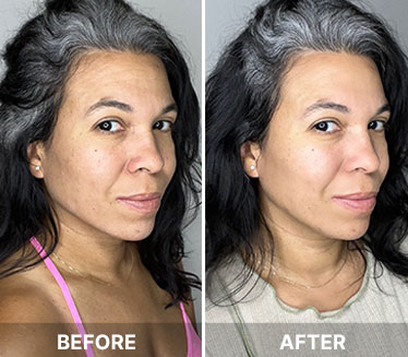 Before and after results
