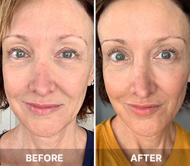Before and after results