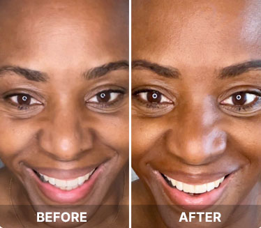 Before and after results