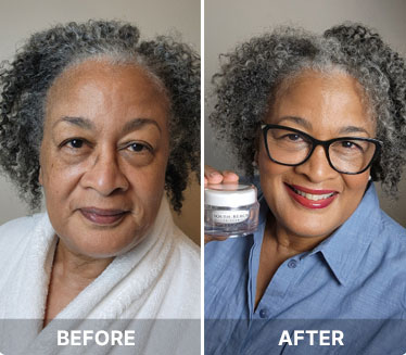 Before and after results